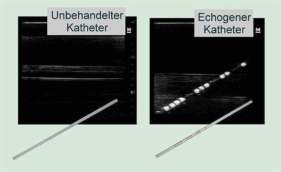 Katheter vor und nach Markierung im Ultraschall