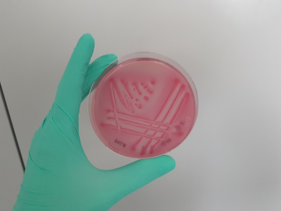 Escherichia coli auf MacConkey-Agar