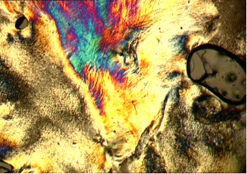 Polarisationsmikroskopische Auf¬nah¬me eines neu hergestellten LCPs mit Poly¬esterimiddianhydrid-Grundstruktur bei 160°C in flüssigkristalliner Phase